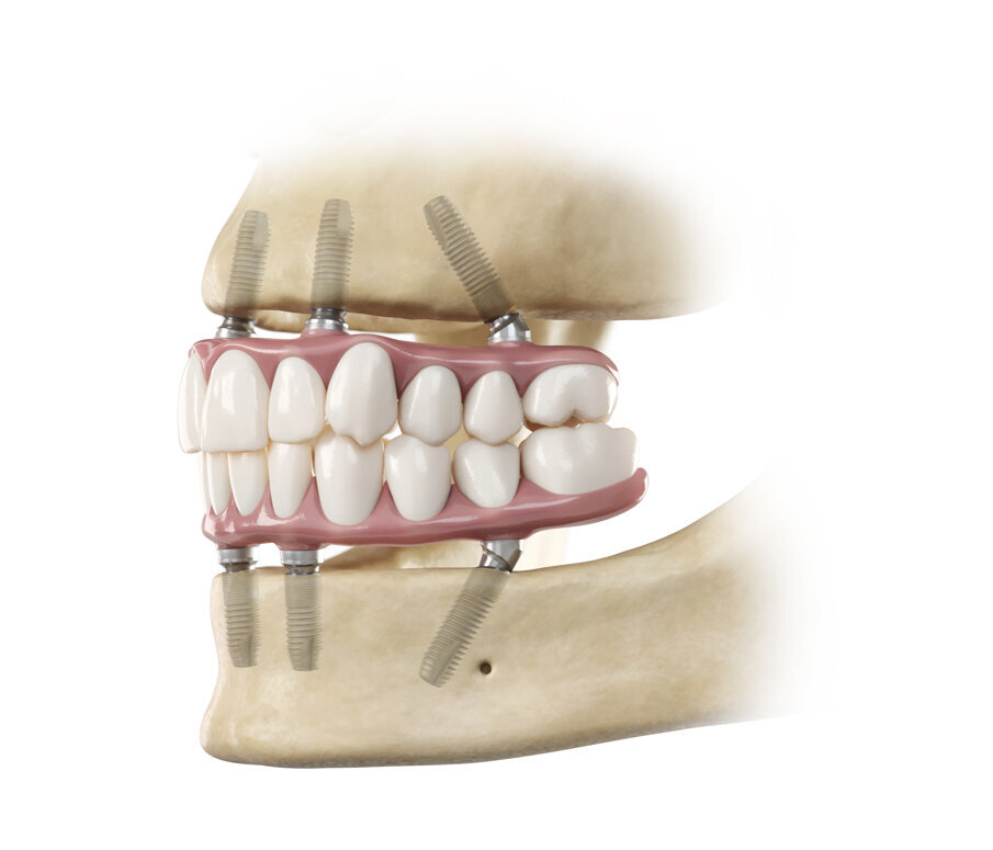 1236590-SmartFix EV 126-GPM