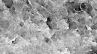 Usuwanie resztek z opracowanych kanałów korzeniowych