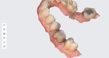 3D printing in dentistry: The secret to offering more for less