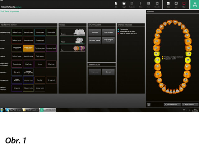 Nastavení individuálních parametrů konkrétního pacienta v programu Zirkonzahn.Archiv. V něm uložené údaje se importují do programu Zirkonzahn.Scan a dojde k fúzi dat.