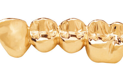 Aurident’s GH gold casting alloy lowers costs Aurident’s GH gold casting alloy lowers costs