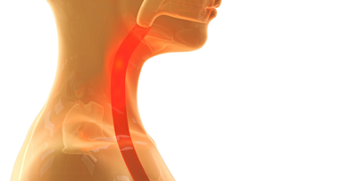 Verschluckte Prothese blockiert Speiseröhre