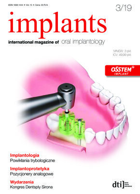 implants Poland No. 3, 2019 implants Poland No. 3, 2019