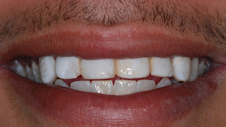 ¡Estética no se escribe con $!