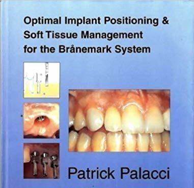 Optimal Implant Positioning and Soft Tissue Management for the Branemark System