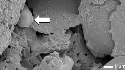 Mascar chiclete contribui para a manutenção da saúde bucal