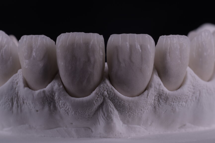 Fig. 68: Ceramic after the first firing.