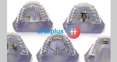 Una técnica que reduce el tiempo de tratamiento de la ortodoncia invisible