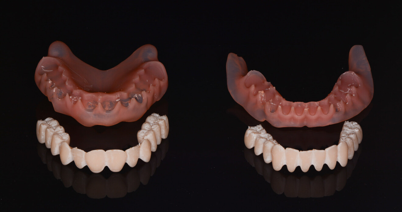 Fig. 6: 3D-printed denture bases and tooth segments after post-processing.