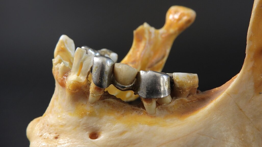 Nowy materiał pomoże w leczeniu zakażeń kości