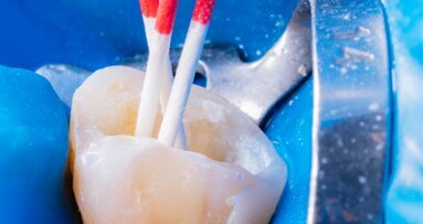 A rare variation in the root canal anatomy of a premolar