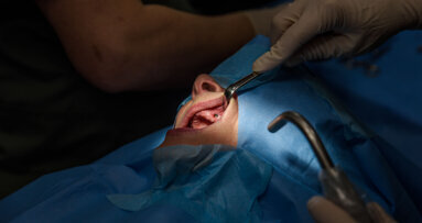 Implant treatment of the fully edentulous patient—contribution of digital techniques