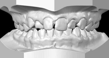 Align completes acquisition of Cadent