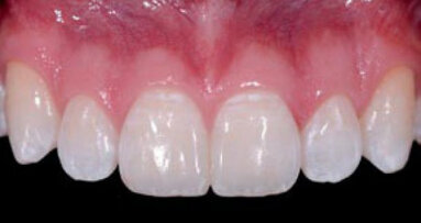 El color y la forma: objetivos de la estética