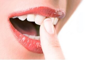 Wrażliwe zęby też mogą być białe