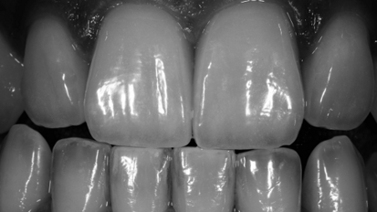 “Aesthetic dentistry in itself means nothing”