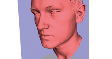 Cefalometria Radiation Free possibile e auspicabile alternativa diagnostica?