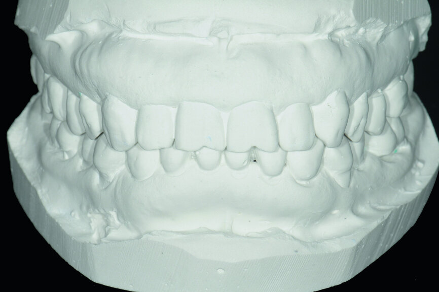 Fig. 11: Precise pre-operation model.