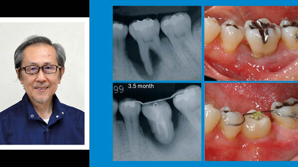 Световният експерт по автотрансплантация д-р Мицухиро Тцукибоши идва за първи път в България