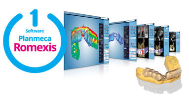 7 semplici passi per un flusso di lavoro completamente digitale in implantologia