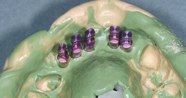 Opětovné implantologické ošetření