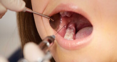 Jste frustrovaní ze selhávání lokální anestezie?