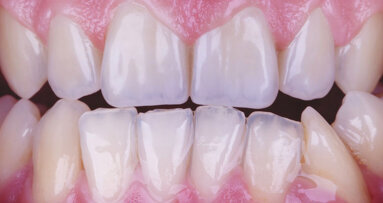 Hay que elegir siempre el camino más difícil