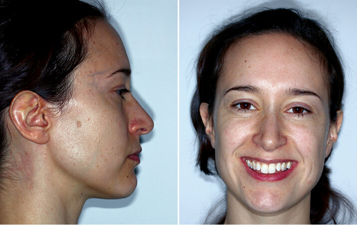 Vstupní foto a RTG dokumentace