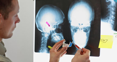 Norwegian study finds high pain intensity is a risk factor of non-resolving TMD