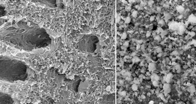 Ново биоактивно стъкло може да спре разграждането на деминерализирания дентин