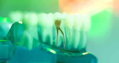 A simple sequence for successful root canal treatment outcomes