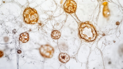 New natural compound therapy shows promise in managing periodontal disease