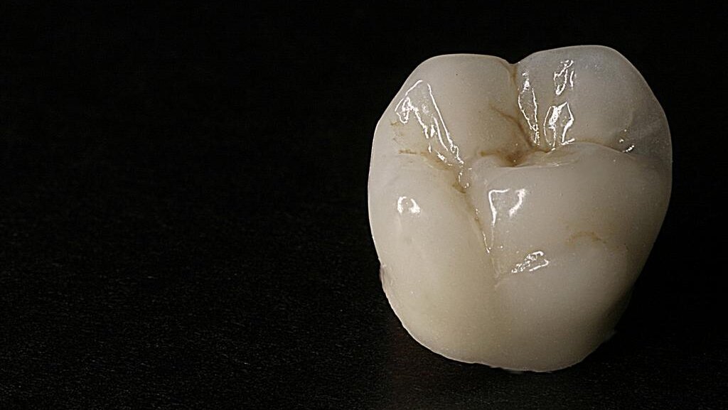 Golden Parallelometer 2011 Yarışması