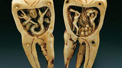 Historia de la Odontología. Capítulo II: La Odontología en las civilizaciones antíguas: Mesopotamia y Egipto