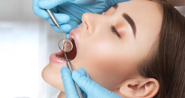 Parodontitis erhöht das Risiko für Schlaganfall und Bluthochdruck