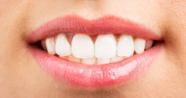 FDI lanceert Proud Mouth Challenge