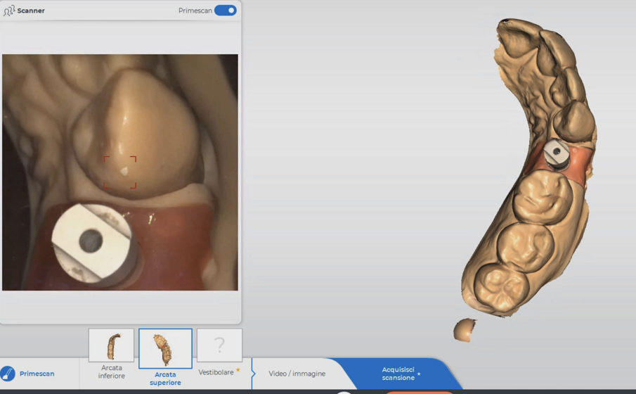 Fig. 11_La chirurgia.