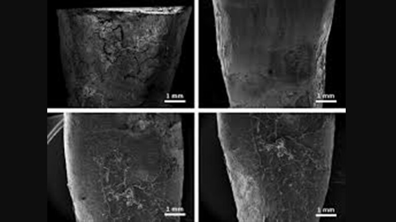 Preservation of root cementum:  A comparative evaluation of power-driven  versus hand instruments