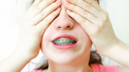 Zahnkorrekturen kein Garant für mehr Selbstbewusstsein Zahnkorrekturen kein Garant für mehr Selbstbewusstsein