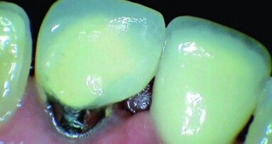 La CFAO au fauteuil est un ajustage naturel pour une pratique des technologies « vertes »