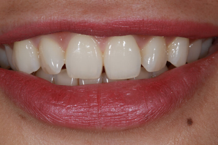 Fig. 6: Initial situation.