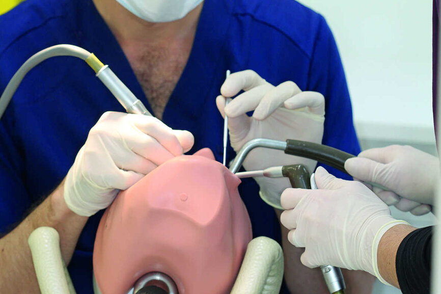 Fig. 4 : Une aspiration coudée à 80° permet à la fois de réaliser la rétraction de la joue et une aspiration optimale permettant le travail sous spray en vision indirecte. 