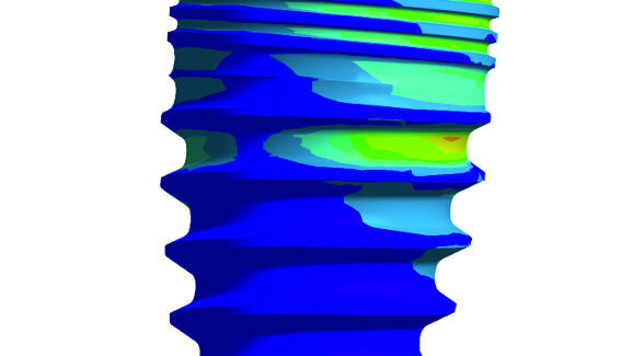 Implantologie: Webinar beleuchtet Grundlagen der Knochenbeanspruchung