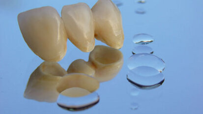 Ein Welser Zahntechnikermeister geht neue Wege