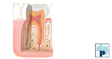 Behandlungschancen bei Parodontitis und Diabetes
