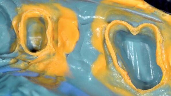 Wycisk, jako ważny etap procedury klinicznej – raport użytkownika