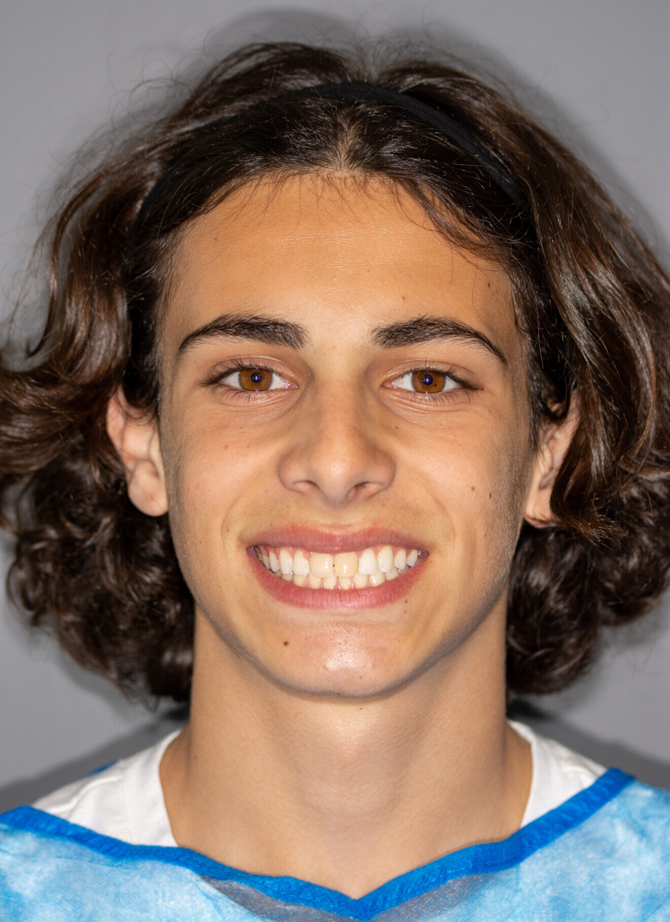 Sourire du patient avant.