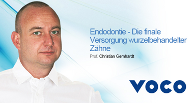 Live-Webinar: Endodontie – Finale Versorgung wurzelbehandelter Zähne