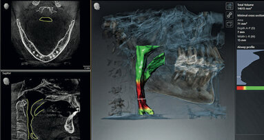 Role of dental professionals in sleep medicine