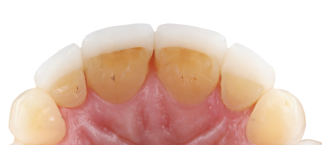 Fig. 24d: Palatal view. 